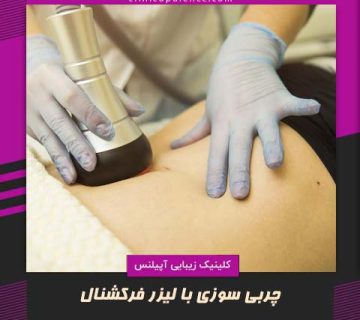چربی سوزی با لیزر