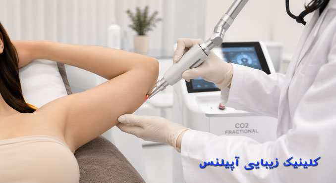 چربی سوزی با فرکشنال لیزر کرج