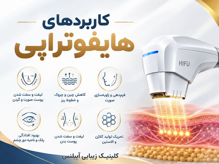 کاربردهای هایفوتراپی در کرج 